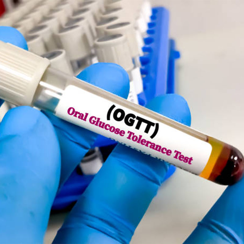 product_Oral Glucose Tolerance Test (OGTT)